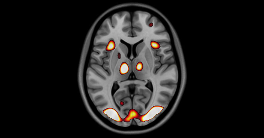 Example of a brain scan from the Wayfinding study